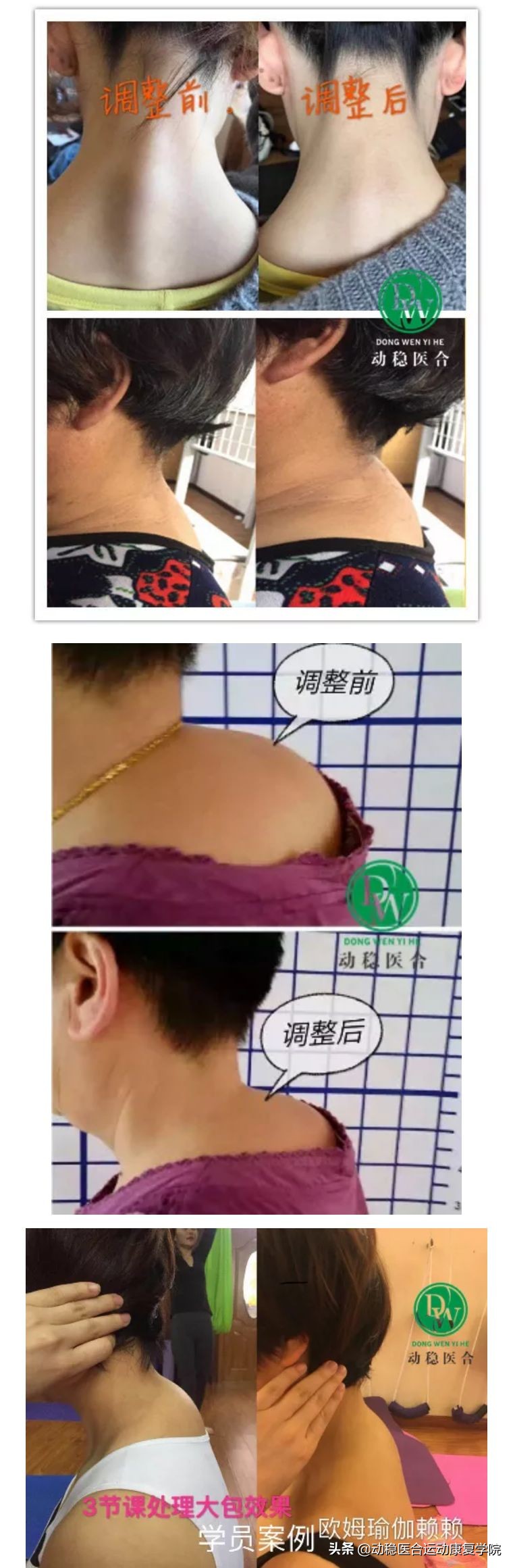 肩背颈椎的康复动作,后背式呼吸好处