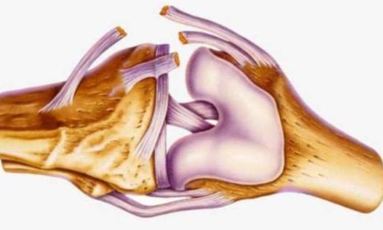 关节镜半月板撕裂手术几天能出院,关节镜半月板修复术后弯曲难