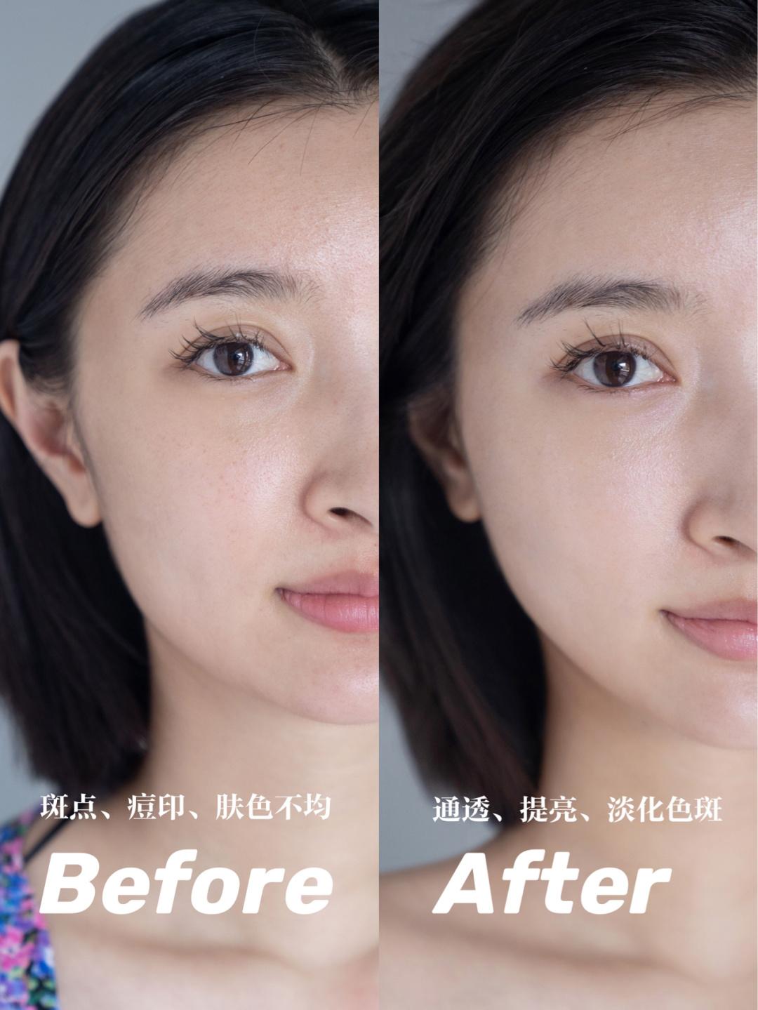 科颜氏提亮美白,小灯泡小银瓶科颜氏淡斑