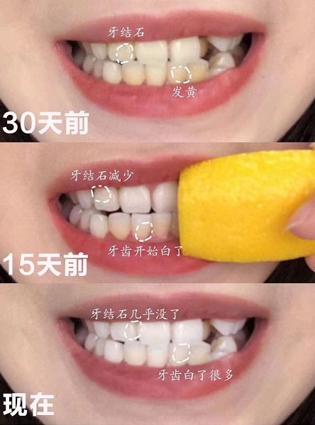 李佳琦巴氏刷牙,李佳琦口嚼式牙膏