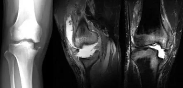 mri临床医师必读电子书,临床医生如何读mri