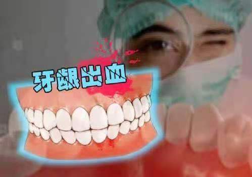 晨起或刷牙时牙龈出血，时好时坏反复发作？两方面解读，受益终身