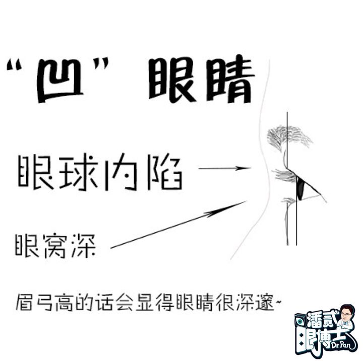 开外眼角会有哪些后遗症,开外眼角的手术后的图片