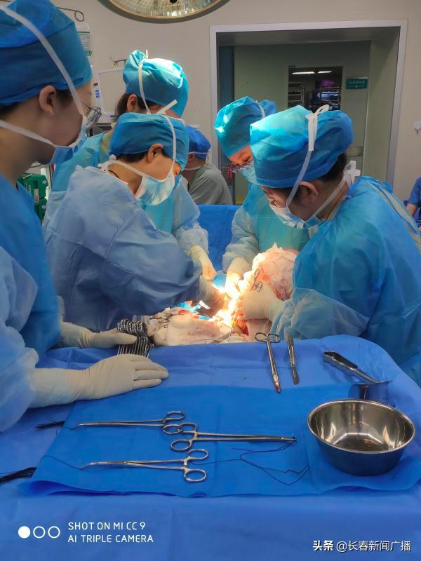 巨大肿瘤被医生成功切除,27岁女子巨大肿瘤切除手术