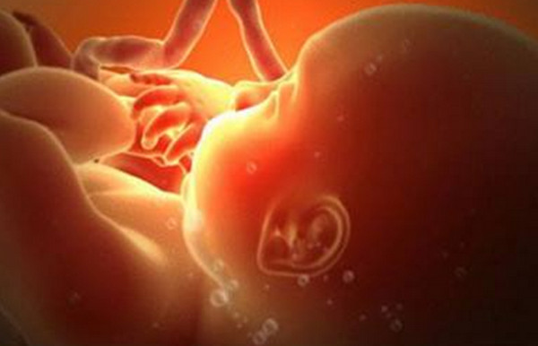 为什么怀孕的羊水叫羊水,为啥胎儿生存的水叫羊水