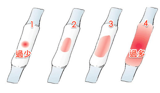 皮下埋植避孕避孕是好方法吗?我猜你还有关于这些副作用的疑问
