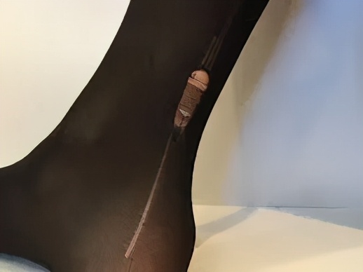 静脉曲张袜要穿多久,蕾丝袜一般能穿多久