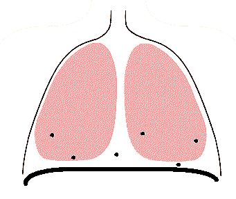 专家建议运动时戴口罩吗,戴口罩运动有好处还是坏处