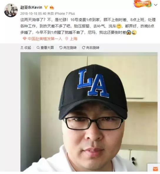 明星为什么头秃不去植发,男明星脱发为何不去植发