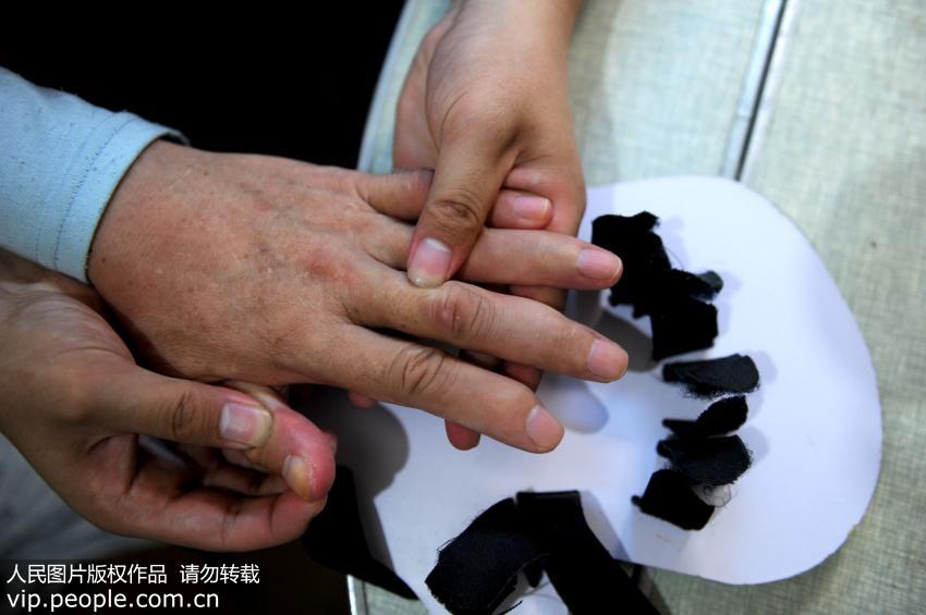 手指断过接上了会有什么后遗症吗,手指断了能自然生长吗