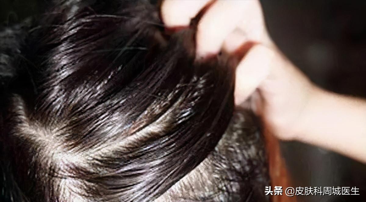 毛发镜检测操作流程,毛发镜检查是什么