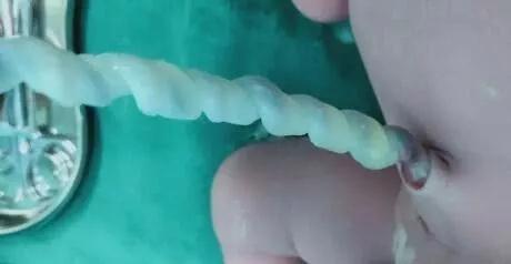 孕妇发现胎儿不对劲怎么办,发现胎儿不怎么动了怎么办