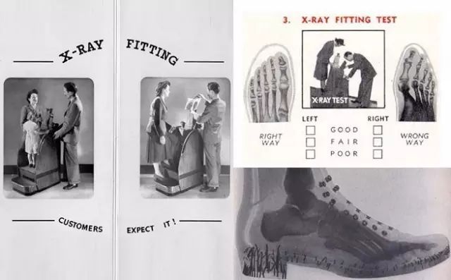 用X光脱毛、试鞋、选美，那些玩X光的勇士最后都怎样了？