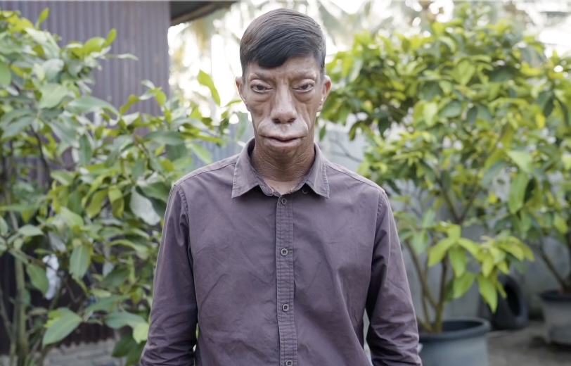 印尼兄妹酷似三星堆,印尼四兄妹怪异长相