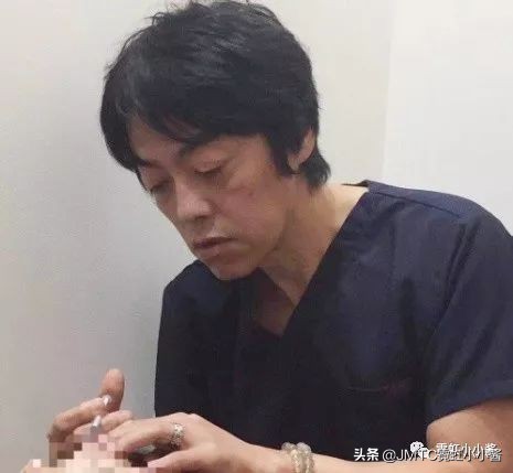 记录翻译小姐姐日本打溶脂针，肉脸变骨感脸全过程｜日本医美