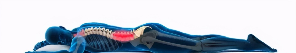 腰椎间盘突出微创要躺多久,腰椎间盘突出可以躺沙发吗