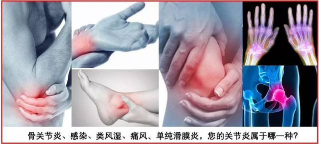 干细胞彻底治关节炎吗,干细胞真的能够治疗骨关节炎吗