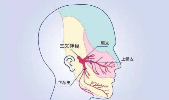 如果牙痛是三叉神经痛怎么治疗,三叉神经痛引起的牙痛怎么办