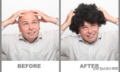 网上卖的止脱生发靠谱吗,解密止脱生发行业