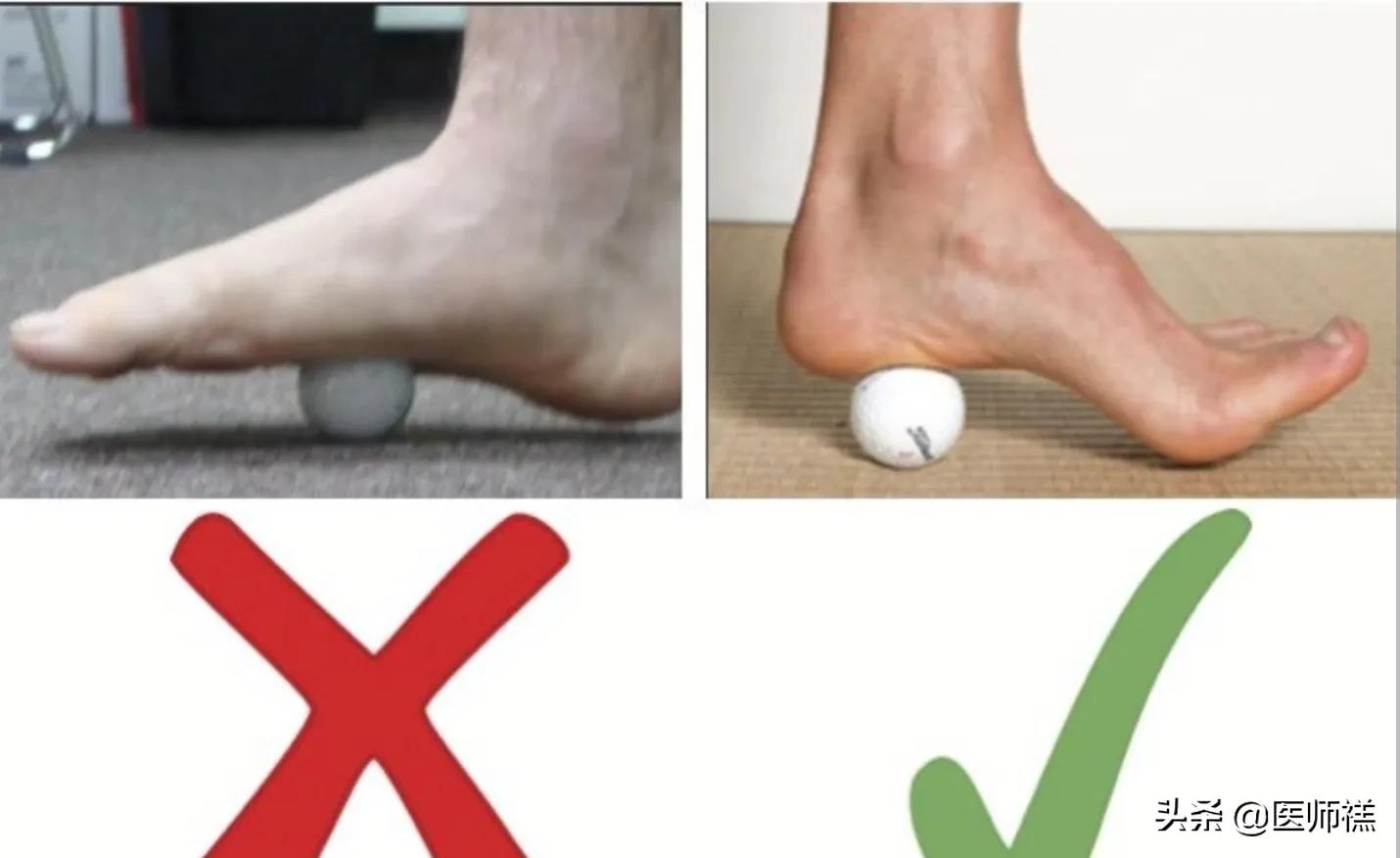 足底筋膜炎吃普通消炎药能缓解吗,足底筋膜炎睡一觉可以缓解吗