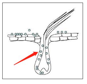狗得了严重脓皮症怎么治,我家的狗得了皮肤病怎么处理