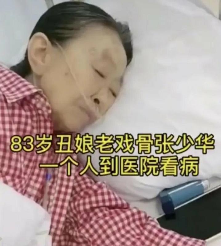 83岁丑娘张少华，生病独自一人去住院，干儿子杨志刚亲自接她出院