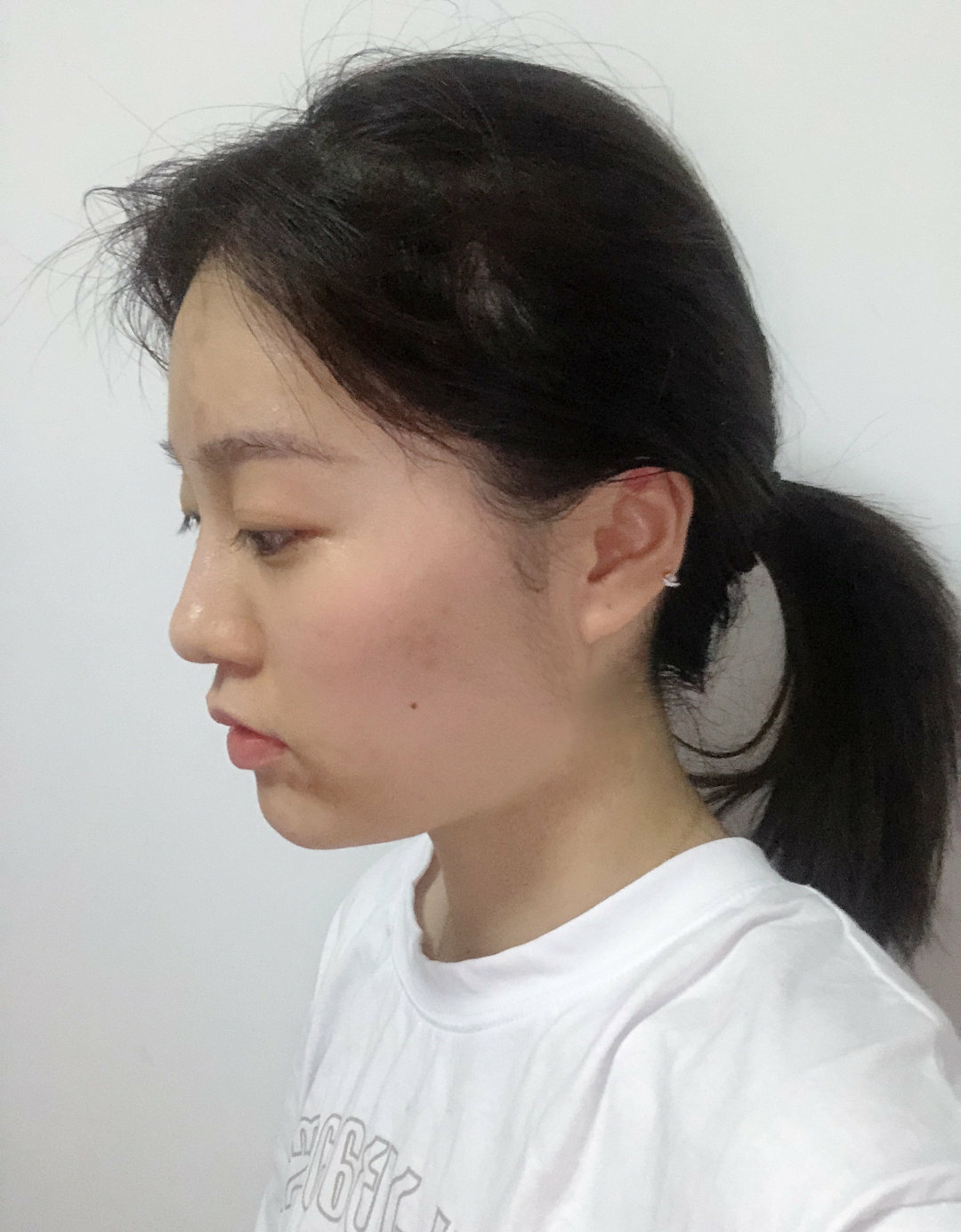 上海首尔丽格鼻子做的怎么样,上海首尔丽格金柱怎么样