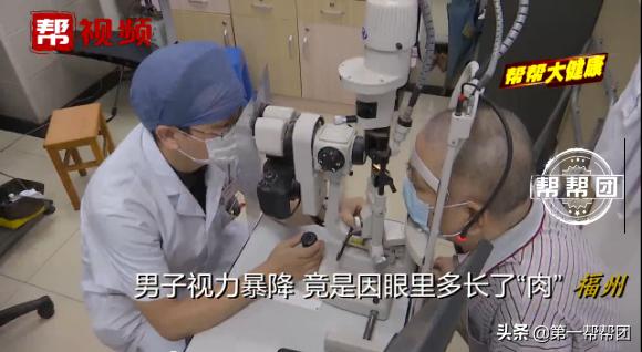 常在海边的注意了！男子视力严重下降，一查竟是眼中长了“肉”