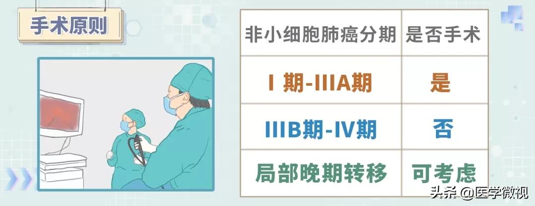 微创治疗肺癌最终是什么结果,肺癌的发病率和死亡率最新数据