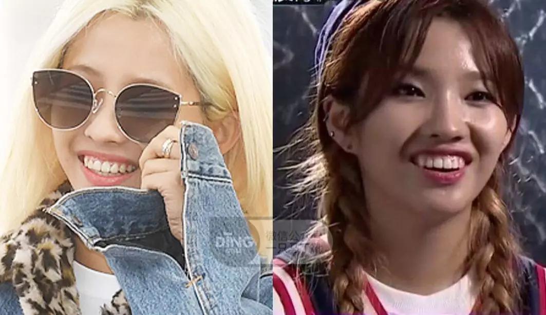 戴牙套凸嘴怎么化妆,凸嘴整牙削骨吗