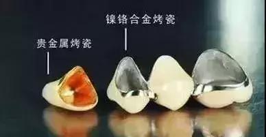 想配一副全瓷假牙要多少钱,做镍铬合金好还是钴铬烤瓷牙好