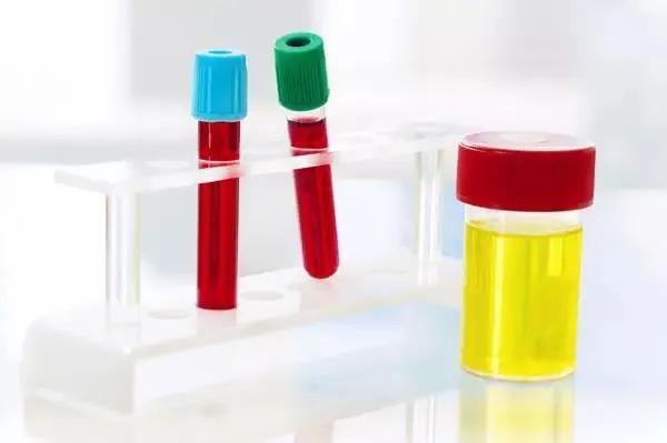 单纯血尿医生说没事,医生说我尿血买啥药治疗快