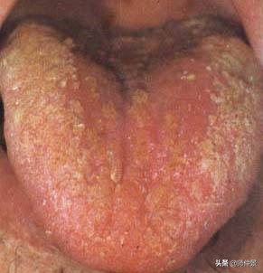 最实用的舌诊图六大舌象,舌诊深入学习书