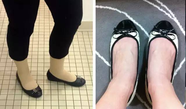脚肥脚宽让鞋子变形怎么恢复原状,又宽又胖的脚适合穿什么样的鞋子