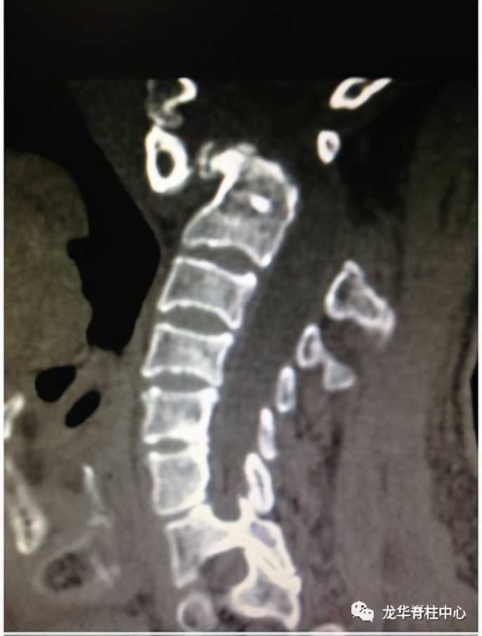 深圳市龙华区人民医院脊柱外科简介