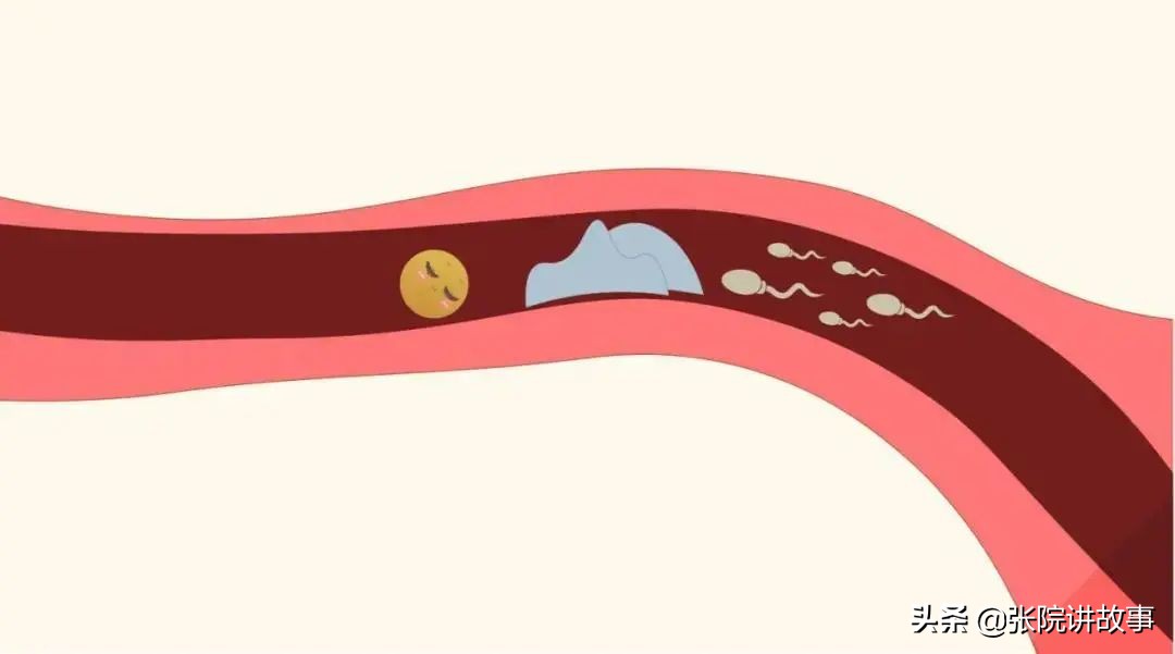「张院讲故事」输卵管不是下水道！千万不要随便通！损伤不可逆