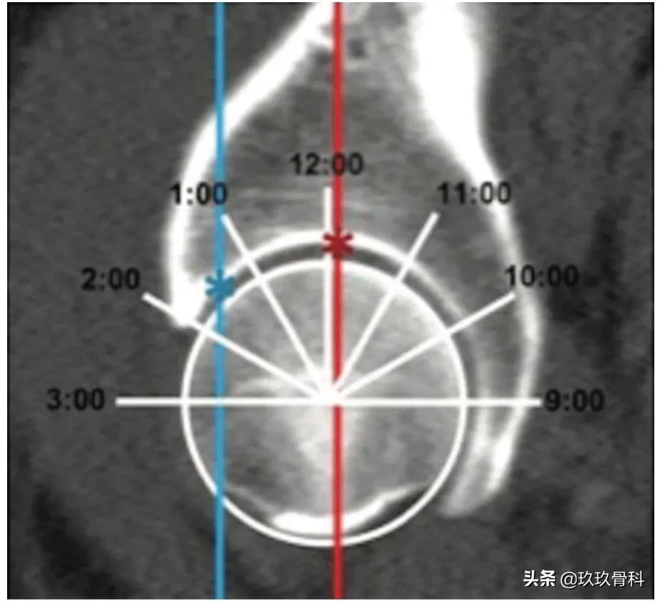 髋膝关节文献精译荟萃