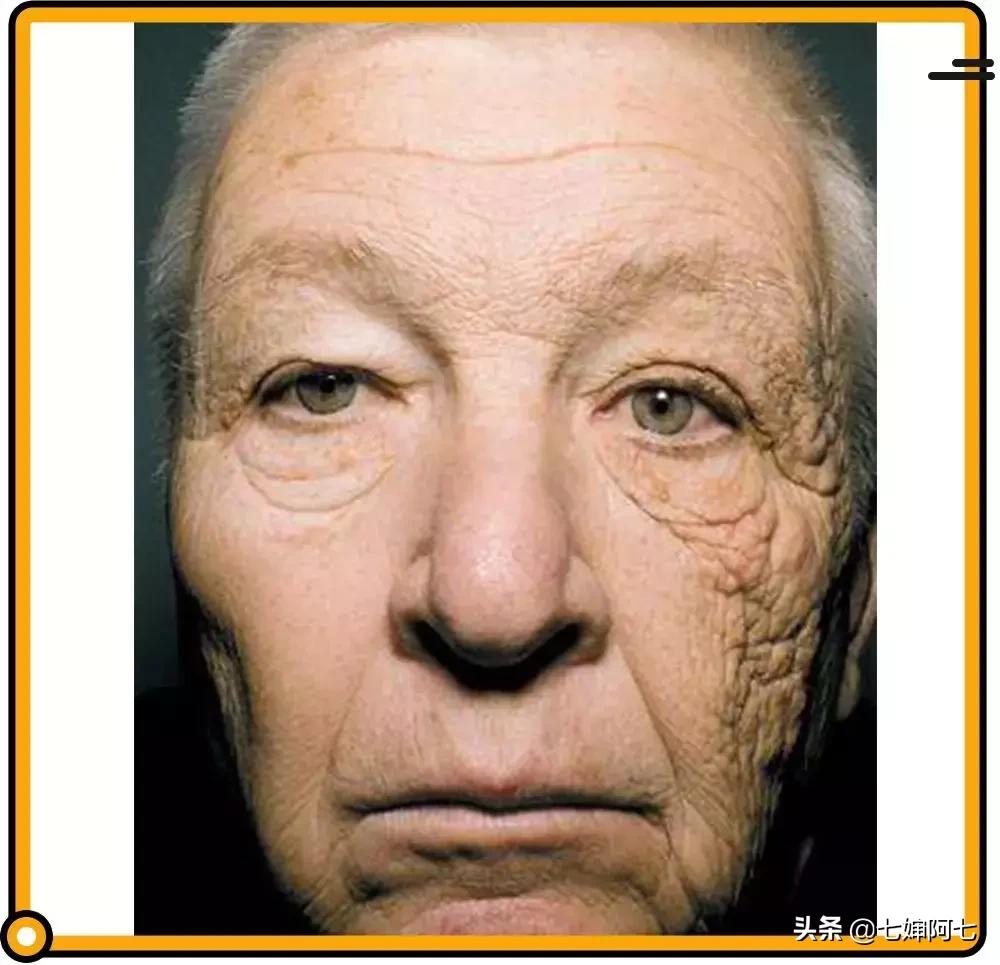 长久都无法消除的黑眼圈,顽固性的黑眼圈要怎么去