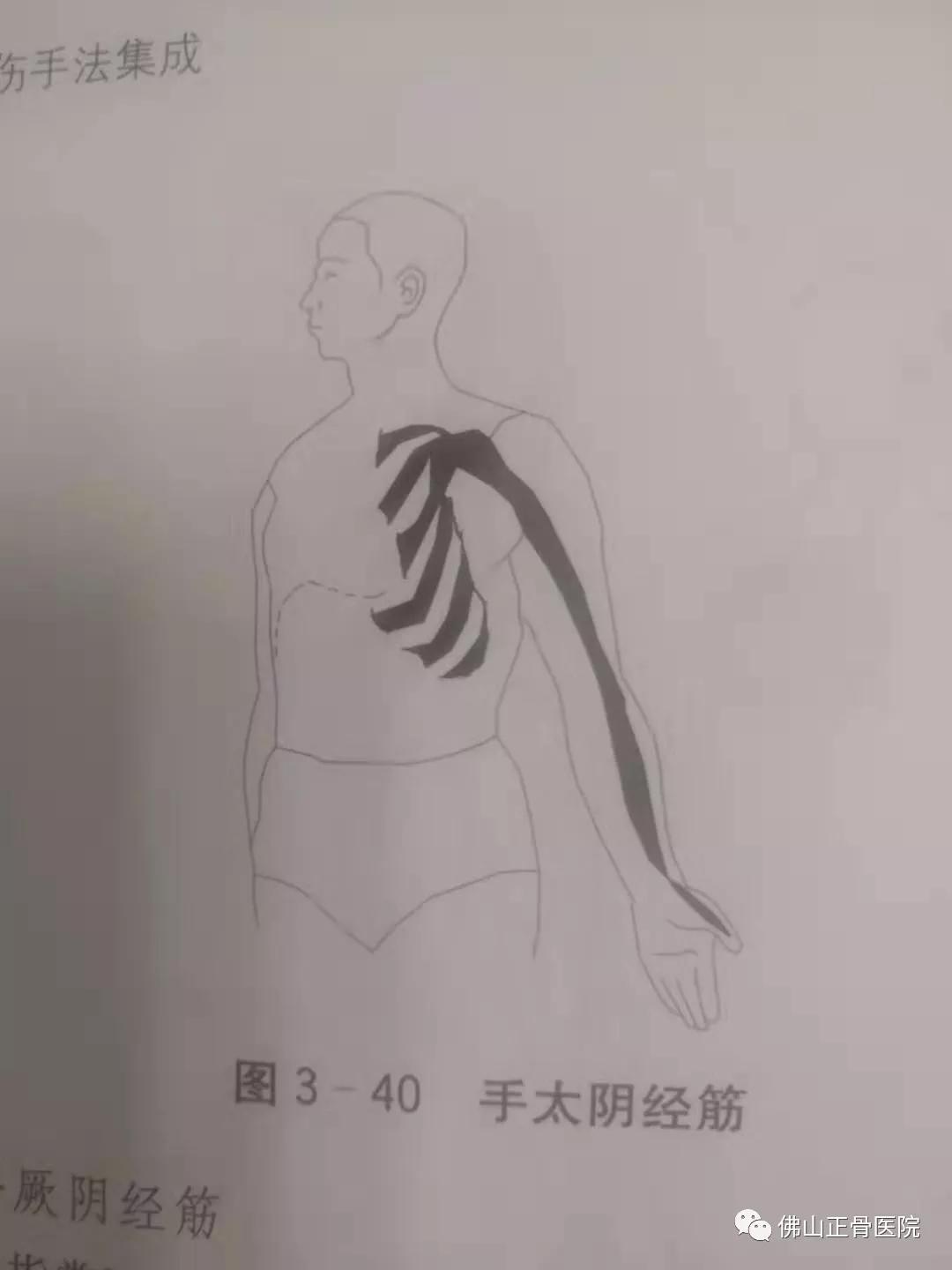 经筋手法，我院名誉院长国医大师韦贵康《韦氏骨伤手法集成》