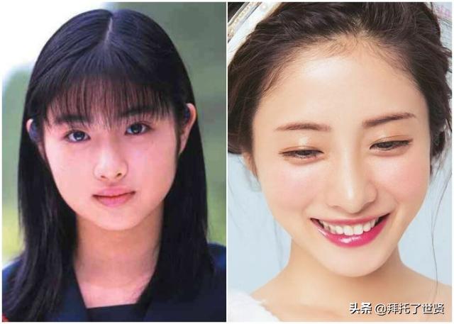 石原里美和佐藤健,石原里美整容之路