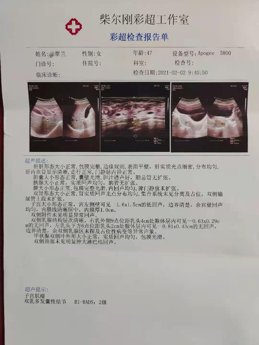 中药可以治乳腺囊性结节,中药治疗乳腺结节与肺结节