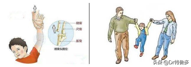 宝宝胳膊拽了一下疼怎么办,宝宝胳膊一拽响