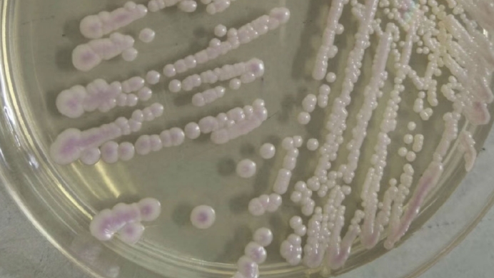 美国爆发真菌感染,美国出现罕见的真菌病了吗