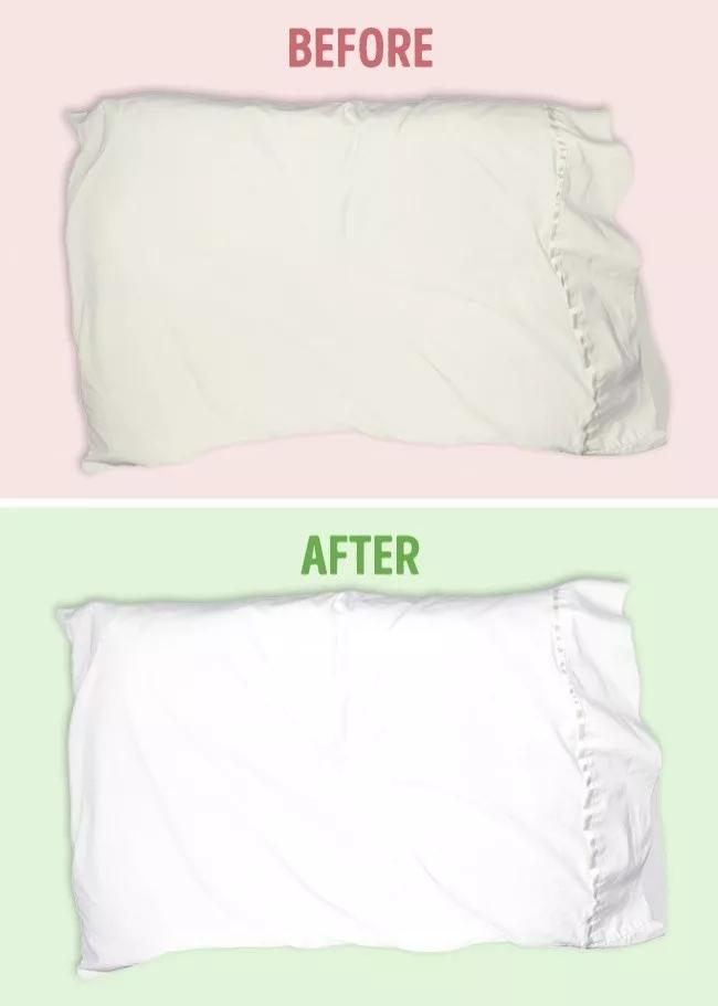 名门泽佳去眼袋红肿结痂图片,名门泽佳去眼袋效果怎么样