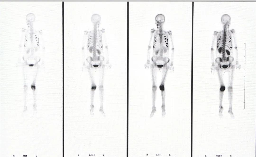 “显”为人知的核医学“神秘”——小“核”才露尖尖角