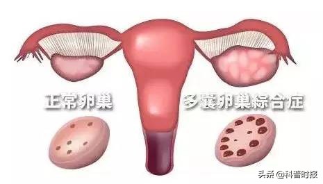 科普卵巢功能视频,科普涨知识卵巢