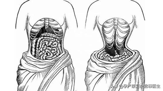 网红束腰真的很神奇吗,网红束腰神器靠不靠谱