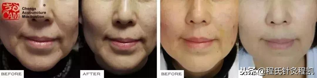 5个永不过时的美容妙招推荐,你需要尝试的10个惊人的美容技巧