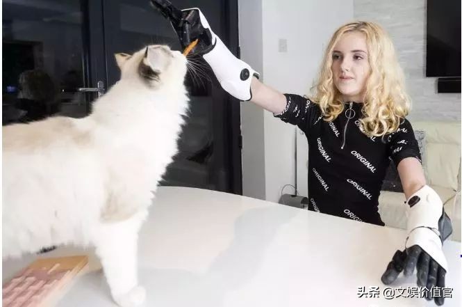 真实版“战斗天使”阿丽塔：13岁机械臂美少女，励志到哭！