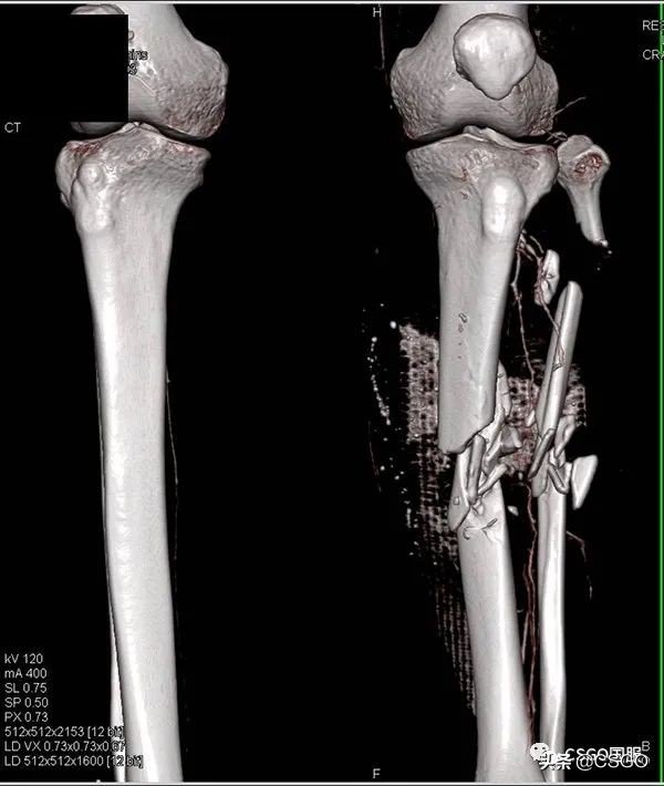 csgo和别的枪战游戏区别,csgo与现实